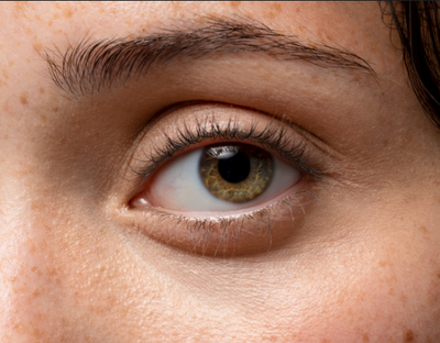 Shields Your Eyes & Brain